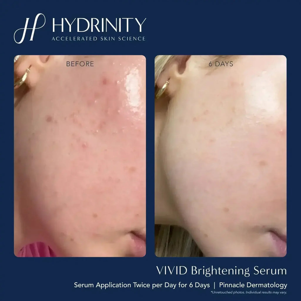 Hydrinity Vivid