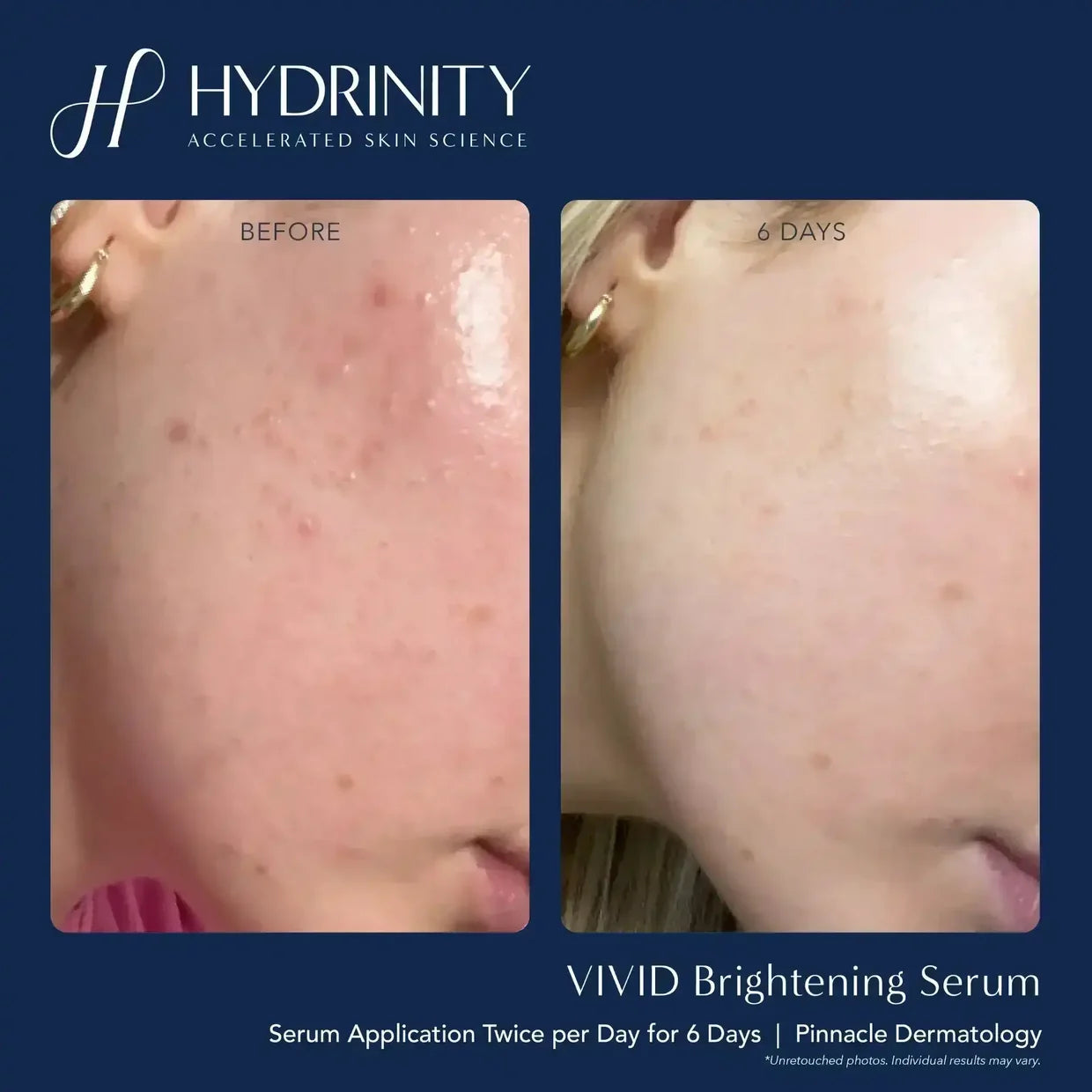 Hydrinity Vivid