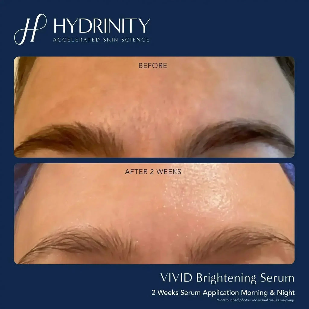 Hydrinity Vivid
