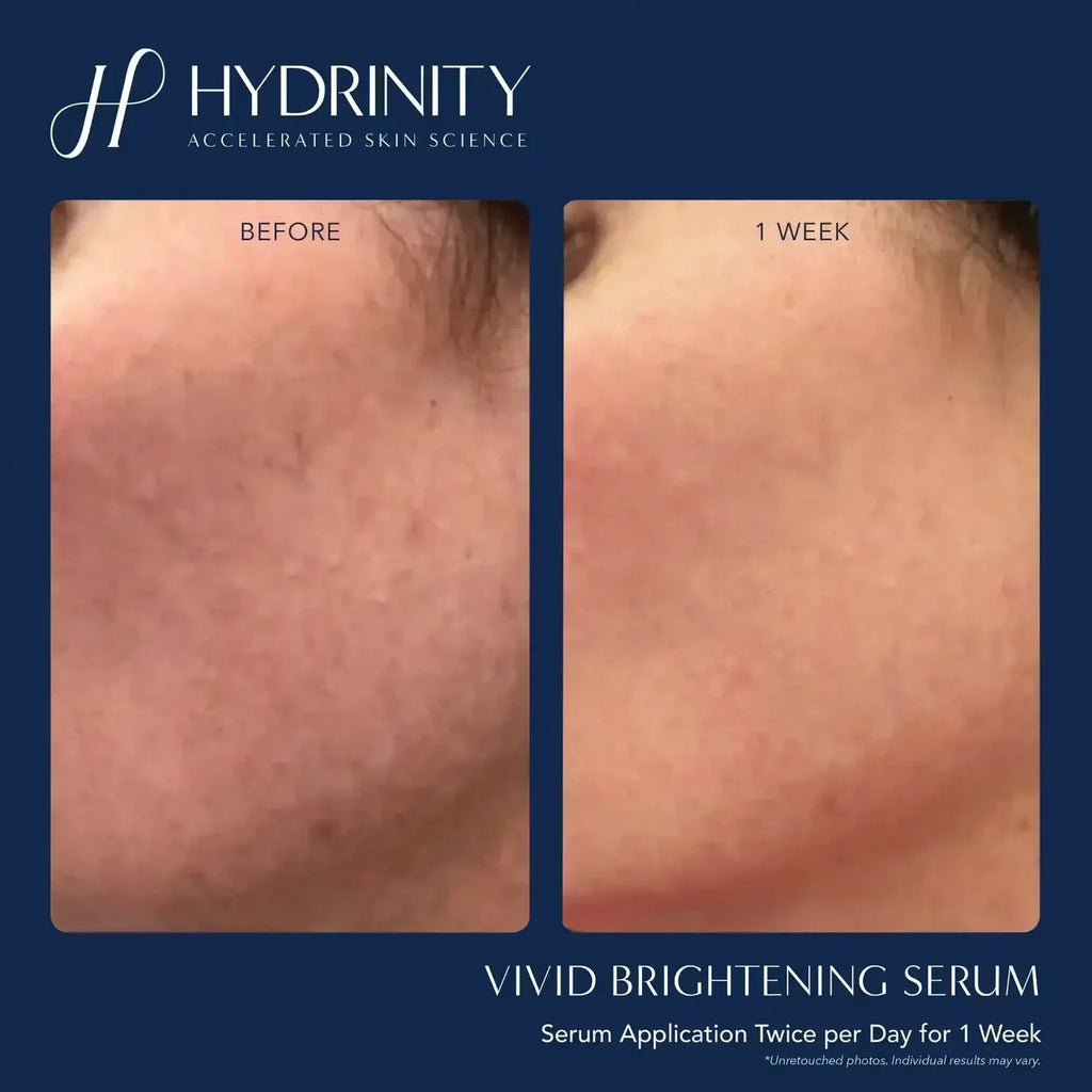 Hydrinity Vivid