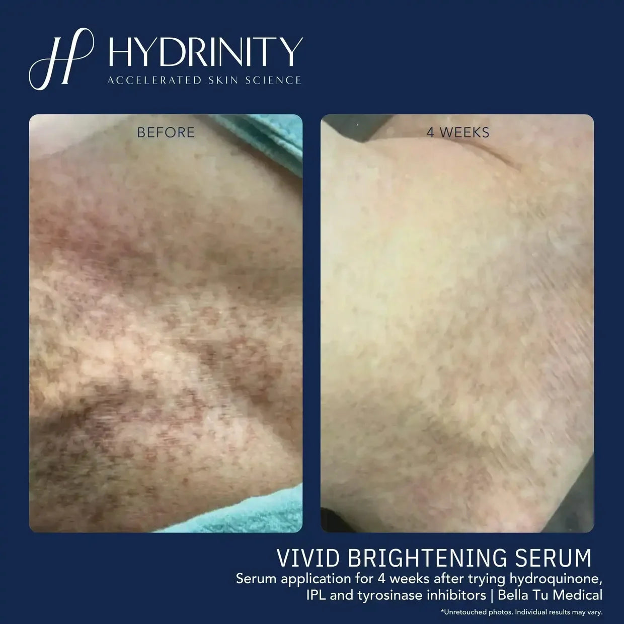 Hydrinity Vivid