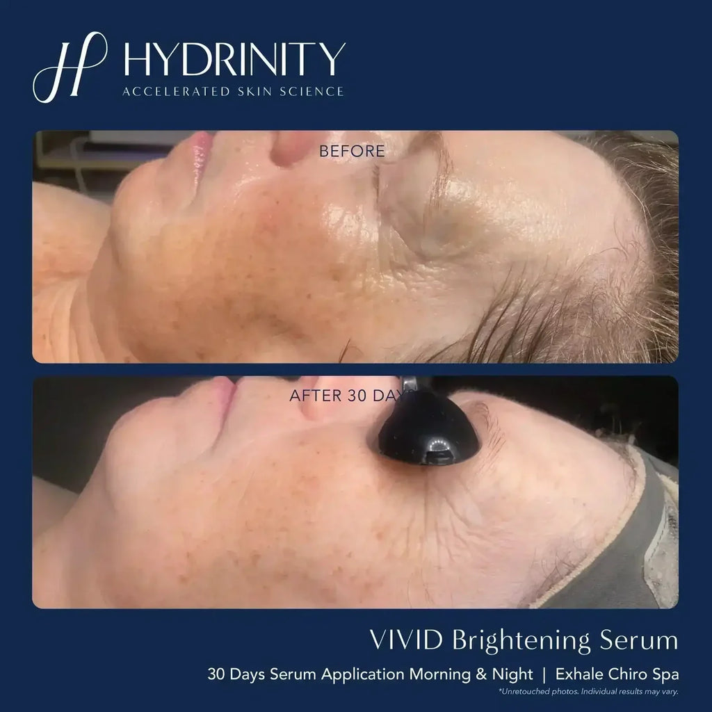 Hydrinity Vivid