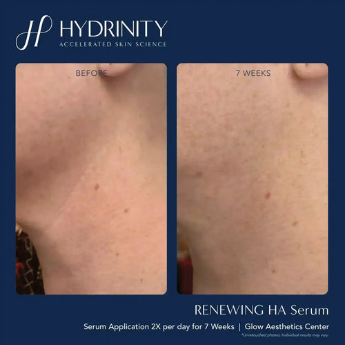 Hydrinity Renewing Serum
