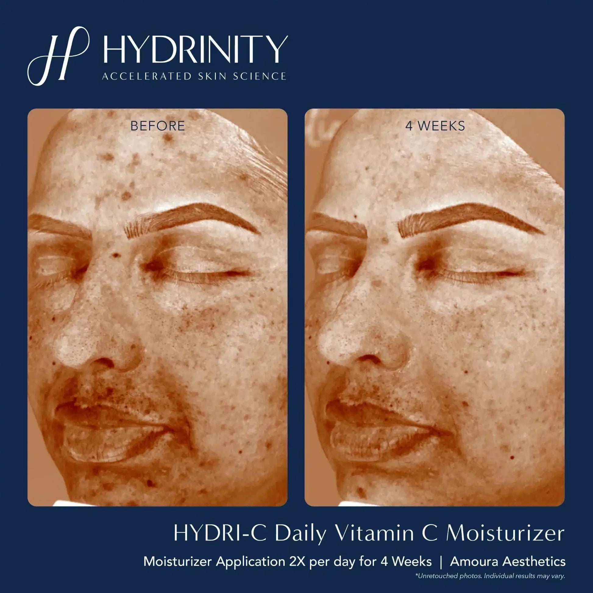 Hydrinity Hydri-C