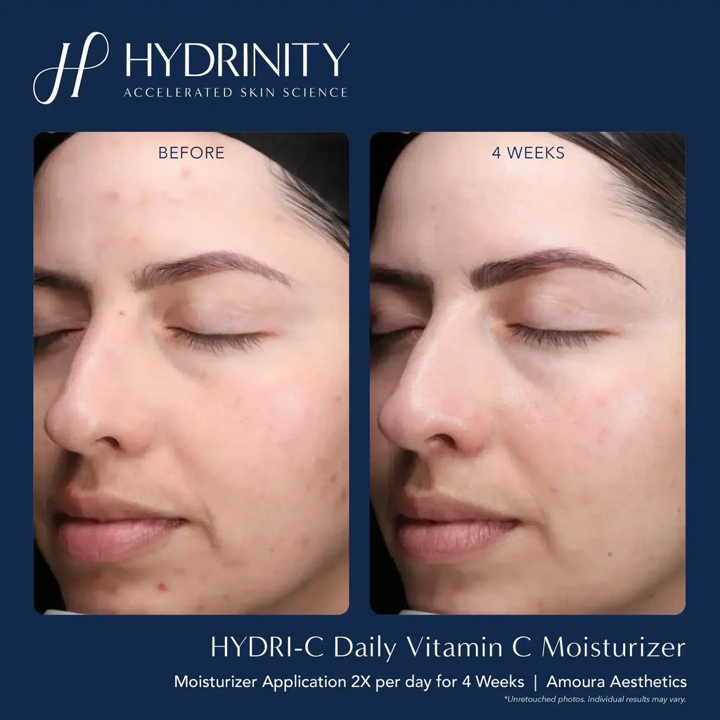 Hydrinity Hydri-C