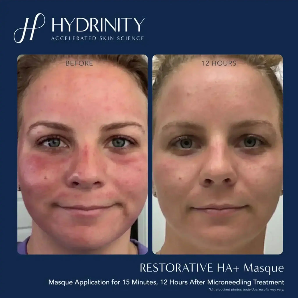 Hydrinity Restorative HA Masque