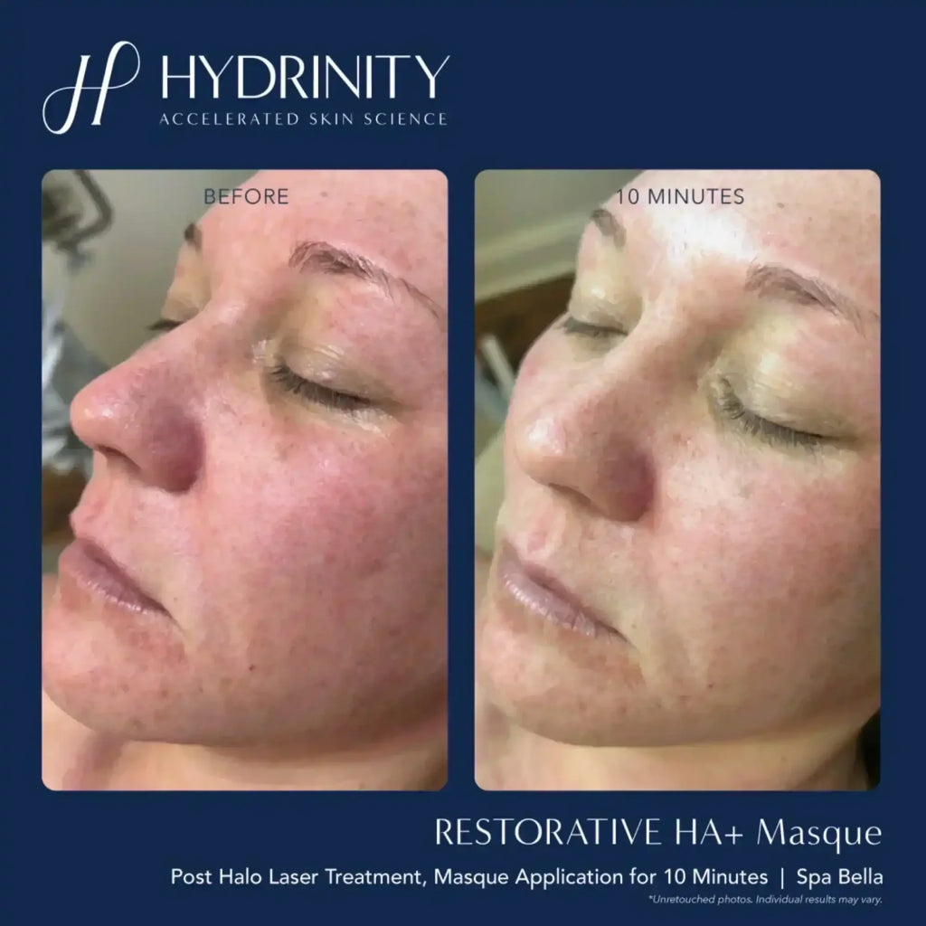 Hydrinity Restorative HA Masque