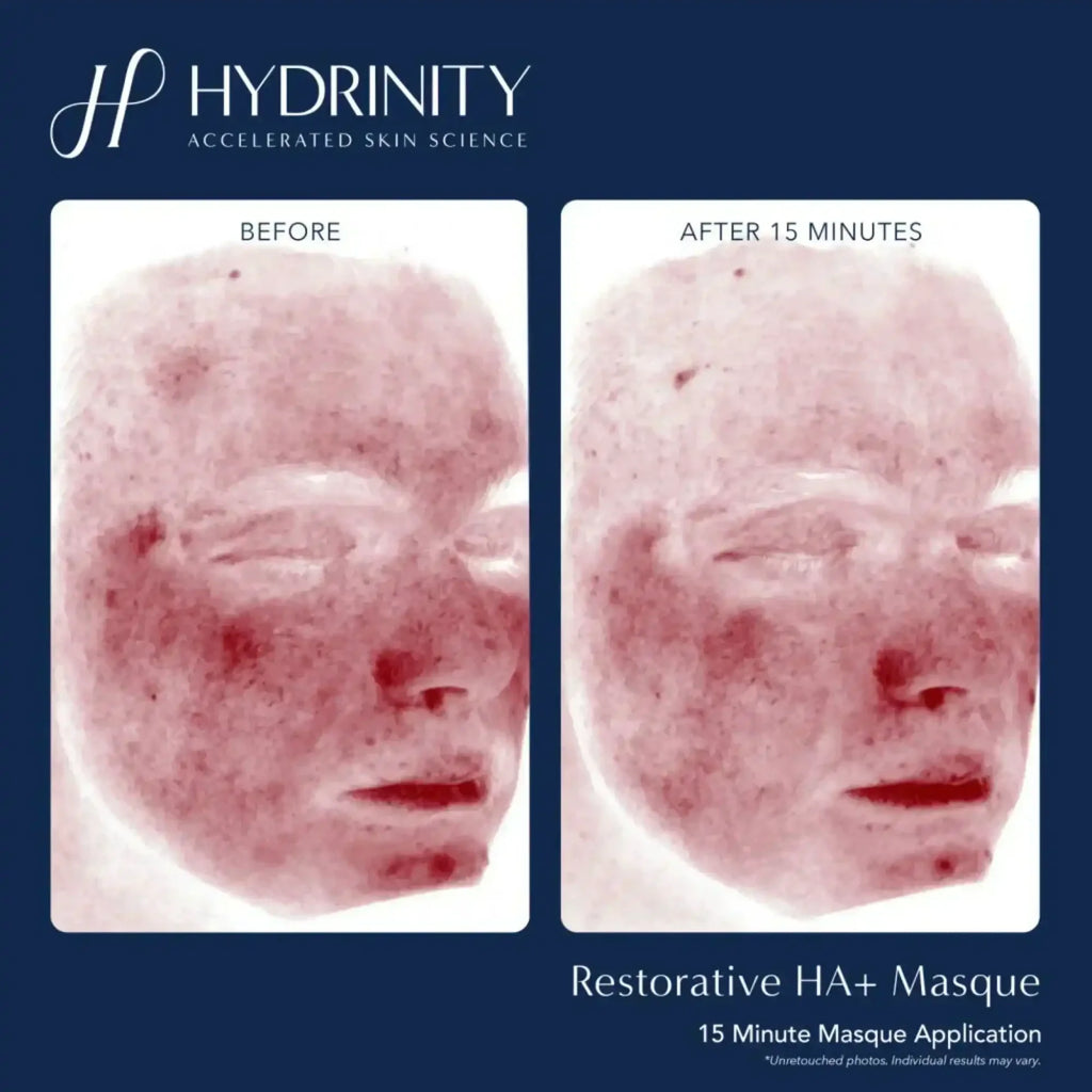 Hydrinity Restorative HA Masque