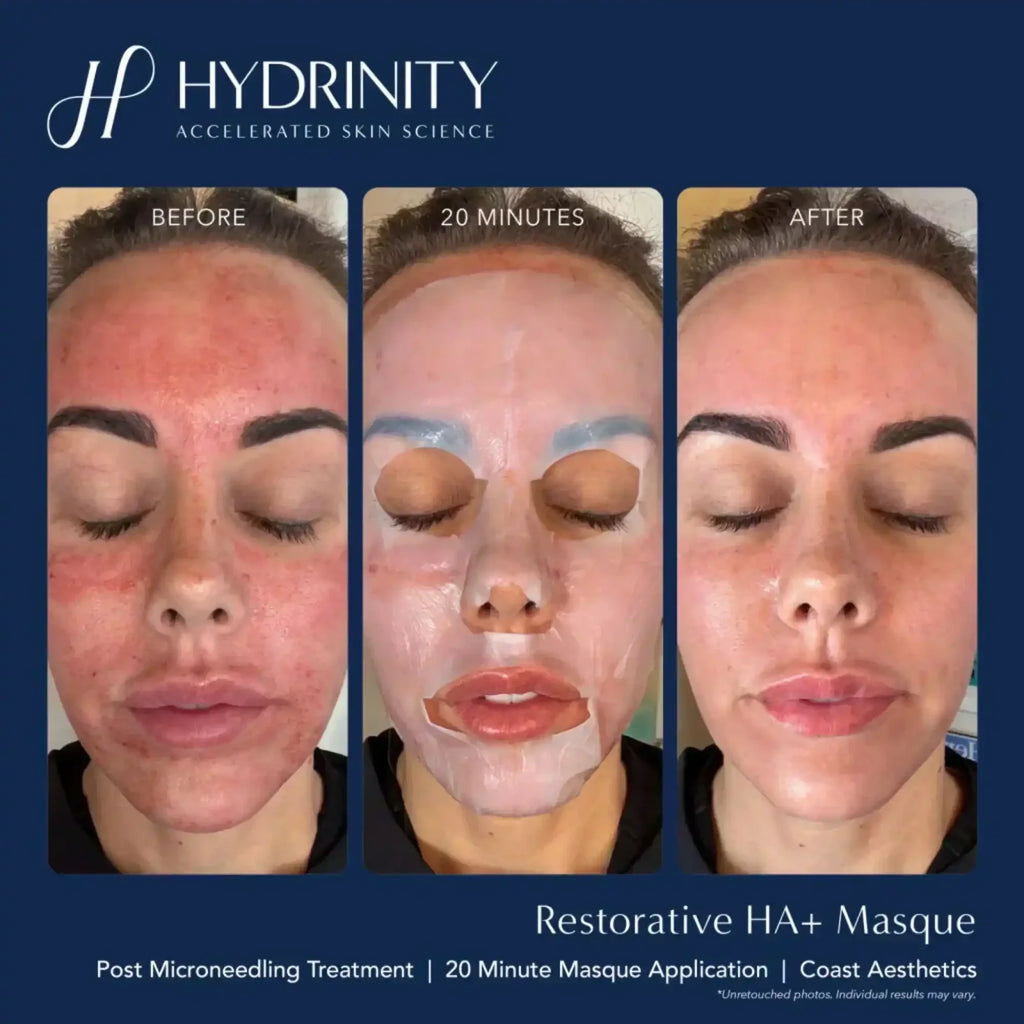 Hydrinity Restorative HA Masque