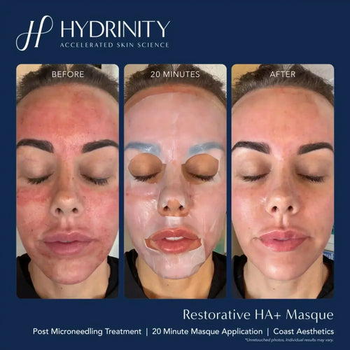 Hydrinity Restorative HA Masque