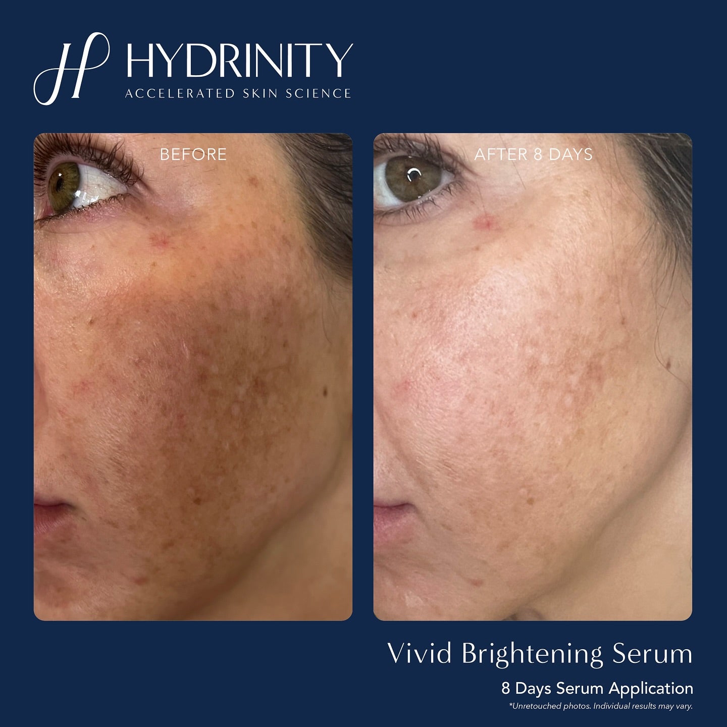 Hydrinity Vivid
