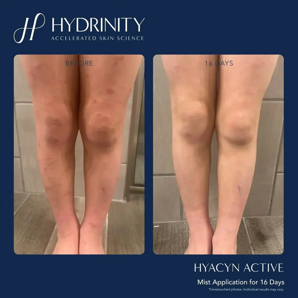 Hydrinity Hyacyn Active Mist