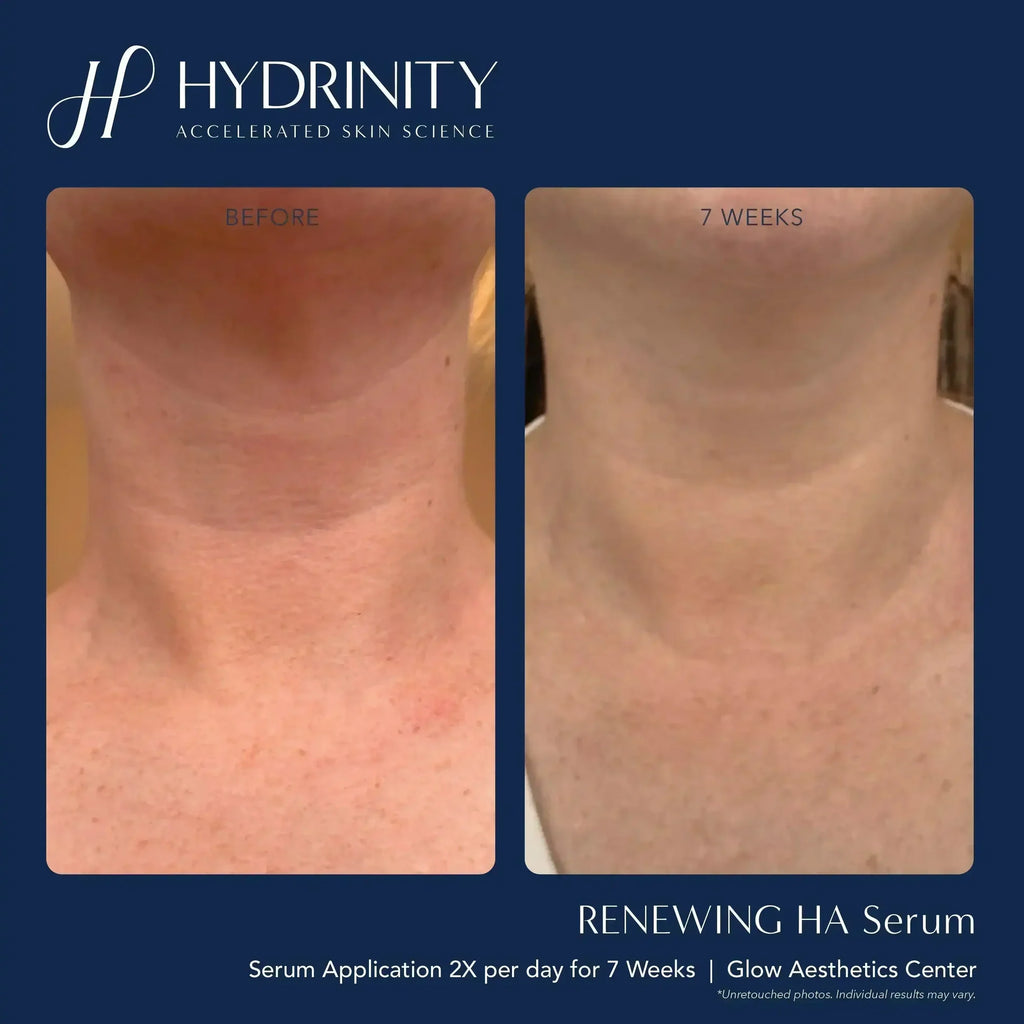 Hydrinity Renewing Serum