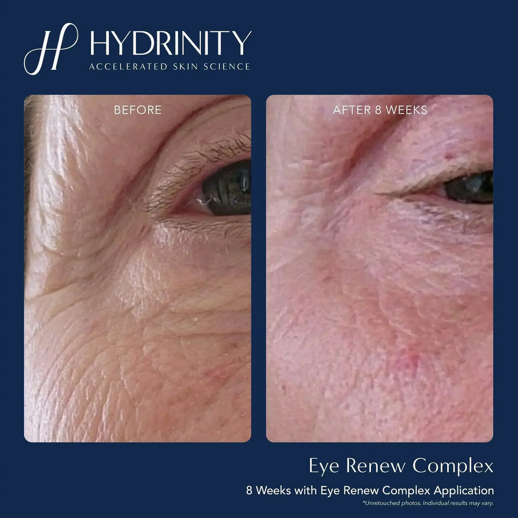 Hydrinity Eye Renew