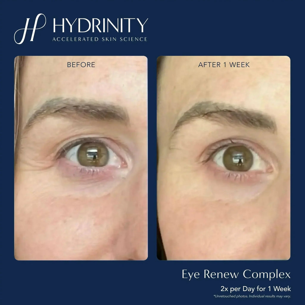 Hydrinity Eye Renew