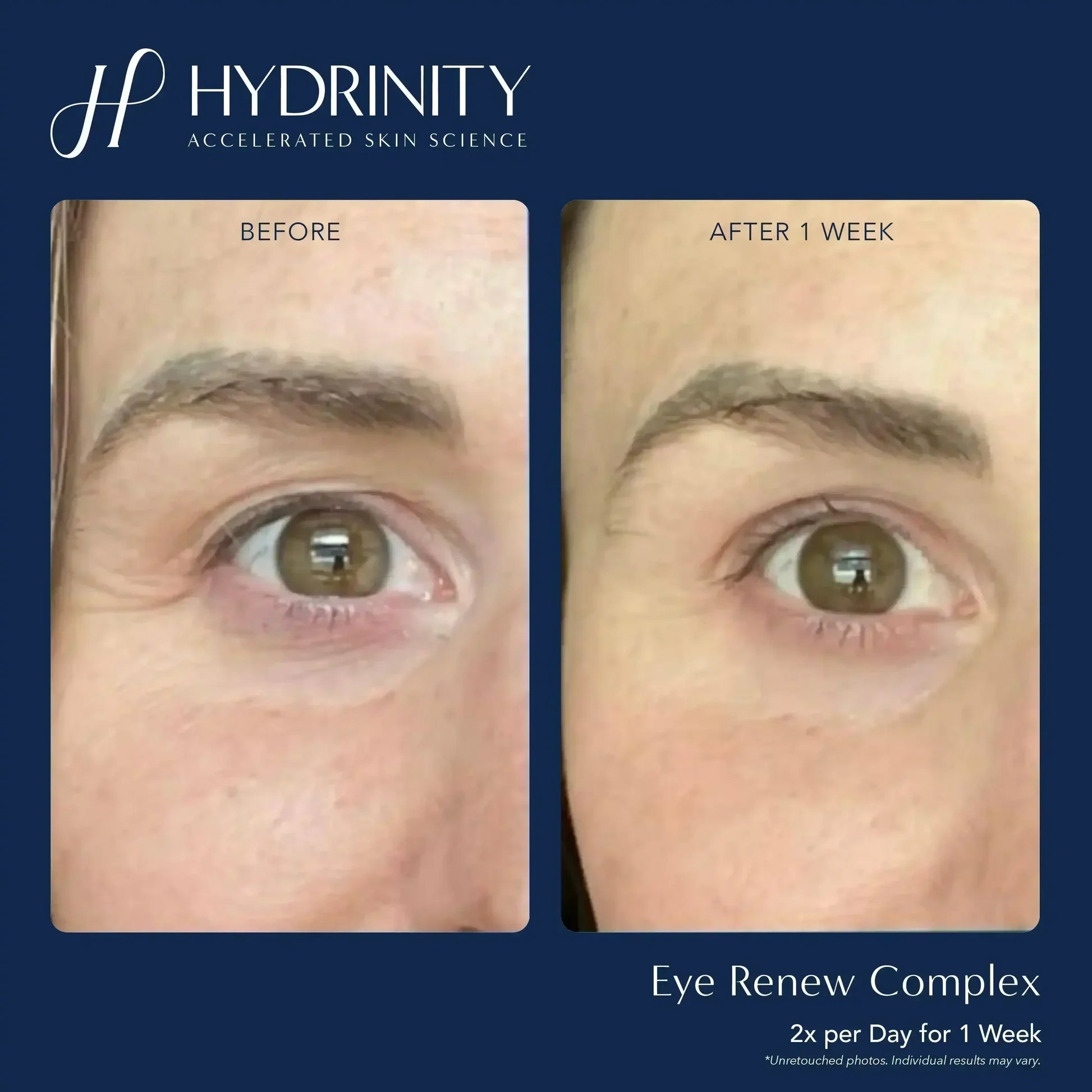 Hydrinity Eye Renew
