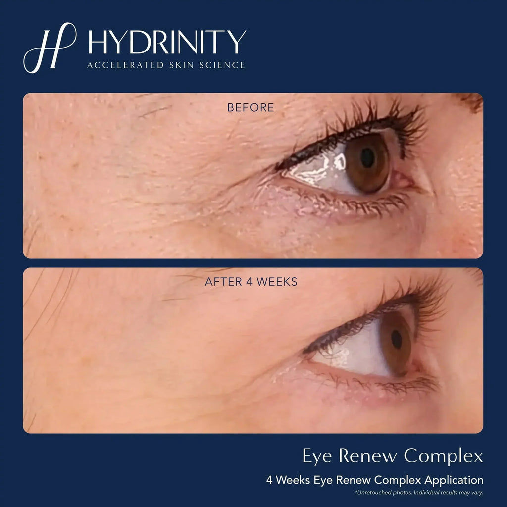 Hydrinity Eye Renew