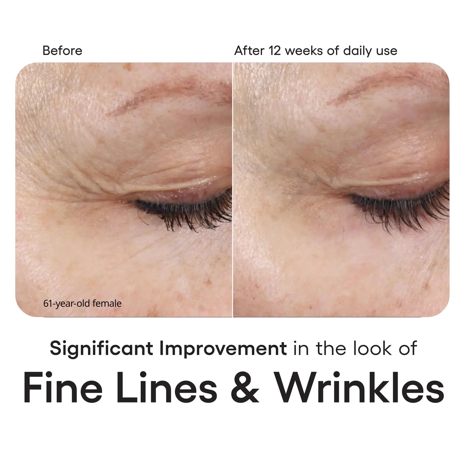 Plated Intense Serum (Refill)